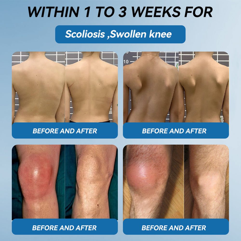 𝐀𝐞𝐞𝙝𝙛𝗲𝗻𝗴® 🌈🌈BPC-157 Joint Healing Cream🦴Treats Arthritis, Neuropathy, Rheumatism, Sports Injuries & More 🤍