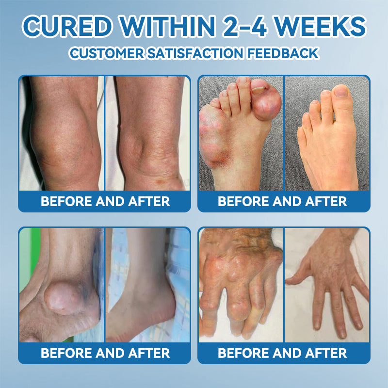 𝐀𝐞𝐞𝙝𝙛𝗲𝗻𝗴® 🌈🌈BPC-157 Joint Healing Cream🦴Treats Arthritis, Neuropathy, Rheumatism, Sports Injuries & More 🤍