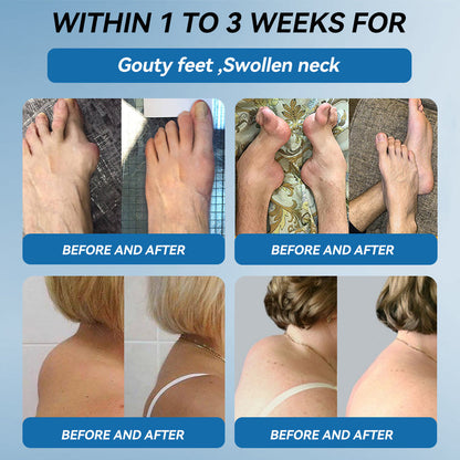 𝐀𝐞𝐞𝙝𝙛𝗲𝗻𝗴® 🌈🌈BPC-157 Joint Healing Cream🦴Treats Arthritis, Neuropathy, Rheumatism, Sports Injuries & More 🤍